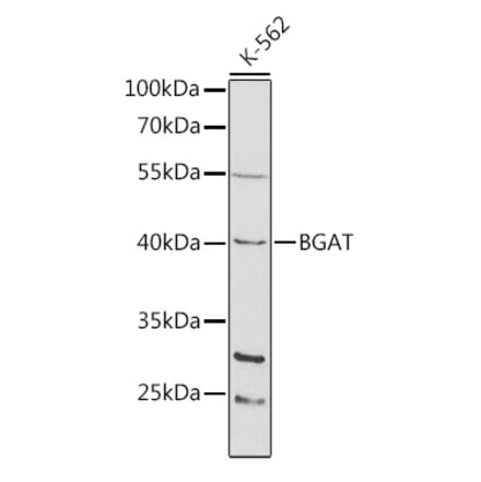 Western Blot - Anti-ABO Antibody (A13526) - Antibodies.com