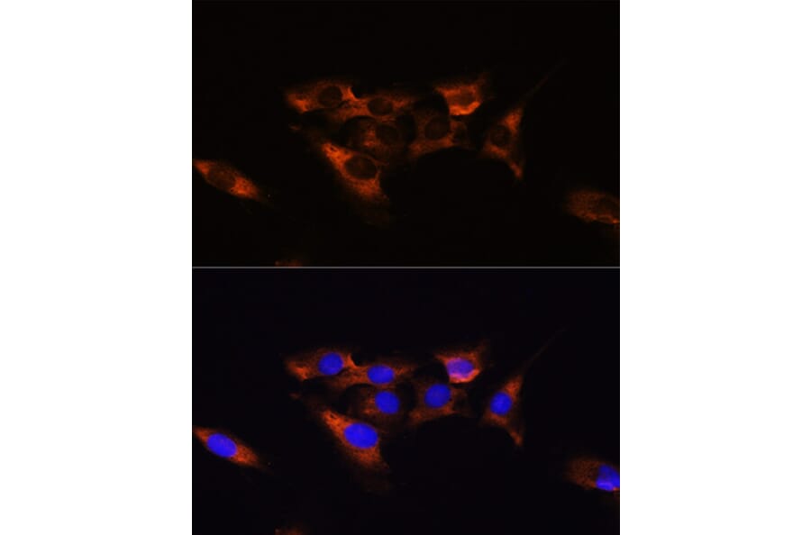 Immunofluorescence - Anti-Adenosine Receptor A2a Antibody (A13527) - Antibodies.com