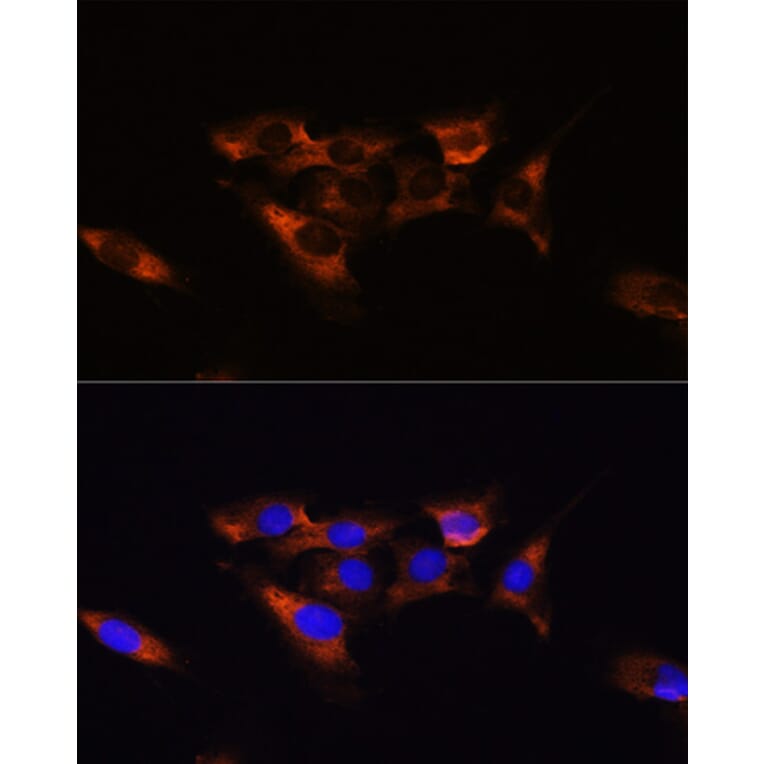 Immunofluorescence - Anti-Adenosine Receptor A2a Antibody (A13527) - Antibodies.com