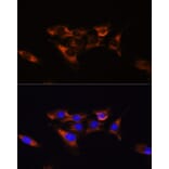 Immunofluorescence - Anti-Adenosine Receptor A2a Antibody (A13527) - Antibodies.com
