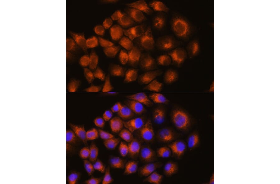 Immunofluorescence - Anti-Adenosine Receptor A2a Antibody (A13527) - Antibodies.com