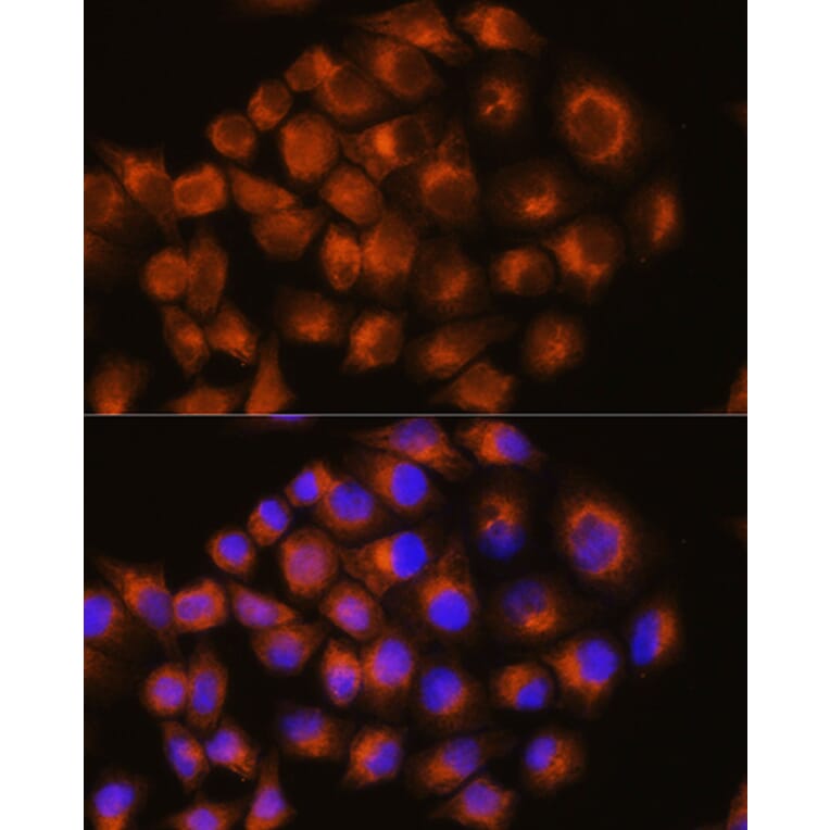 Immunofluorescence - Anti-Adenosine Receptor A2a Antibody (A13527) - Antibodies.com
