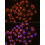 Immunofluorescence - Anti-Adenosine Receptor A2a Antibody (A13527) - Antibodies.com