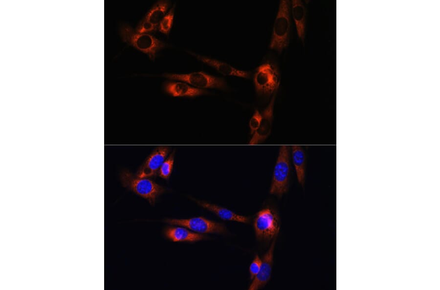 Immunofluorescence - Anti-Adenosine Receptor A2a Antibody (A13527) - Antibodies.com