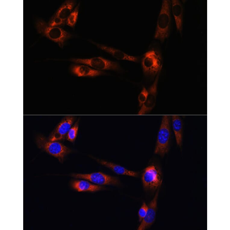 Immunofluorescence - Anti-Adenosine Receptor A2a Antibody (A13527) - Antibodies.com