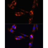 Immunofluorescence - Anti-Adenosine Receptor A2a Antibody (A13527) - Antibodies.com