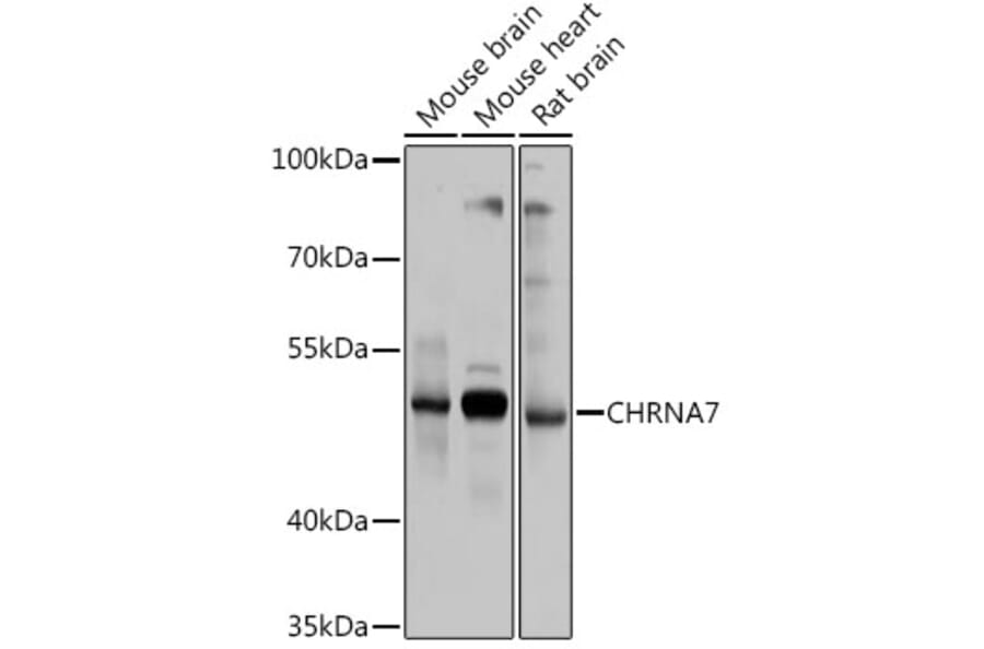 Western Blot - Anti-Nicotinic Acetylcholine Receptor alpha 7 Antibody (A13528) - Antibodies.com