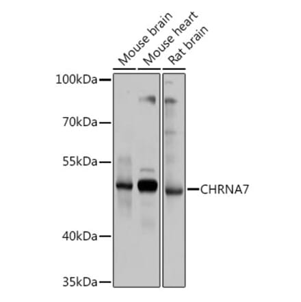 Western Blot - Anti-Nicotinic Acetylcholine Receptor alpha 7 Antibody (A13528) - Antibodies.com