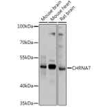 Western Blot - Anti-Nicotinic Acetylcholine Receptor alpha 7 Antibody (A13528) - Antibodies.com