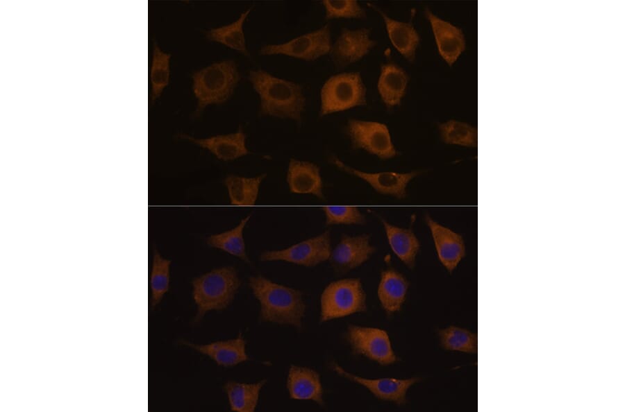 Immunofluorescence - Anti-Nicotinic Acetylcholine Receptor alpha 7 Antibody (A13528) - Antibodies.com