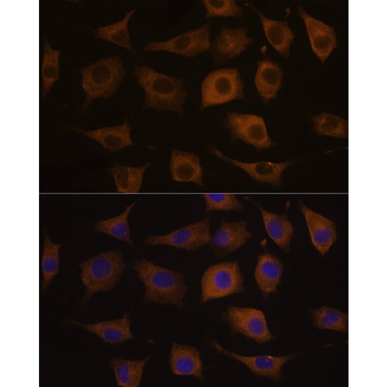 Immunofluorescence - Anti-Nicotinic Acetylcholine Receptor alpha 7 Antibody (A13528) - Antibodies.com