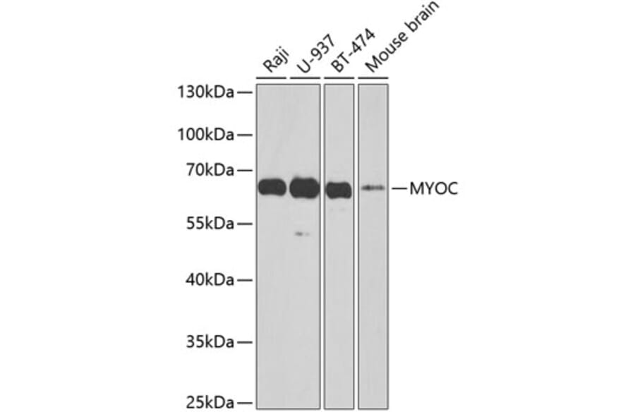 Western Blot - Anti-Myocilin Antibody (A13529) - Antibodies.com