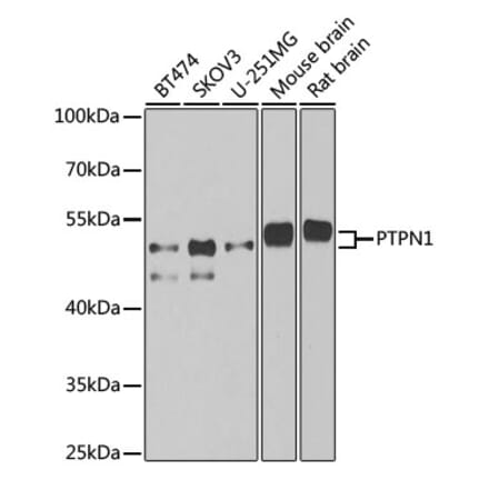 Western Blot - Anti-PTP1B Antibody (A13530) - Antibodies.com