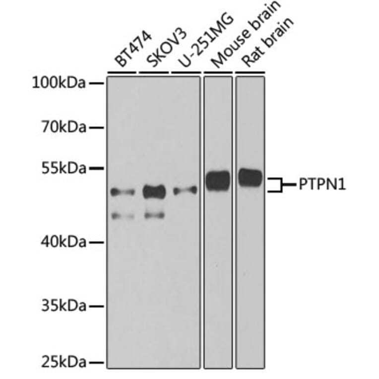 Western Blot - Anti-PTP1B Antibody (A13530) - Antibodies.com
