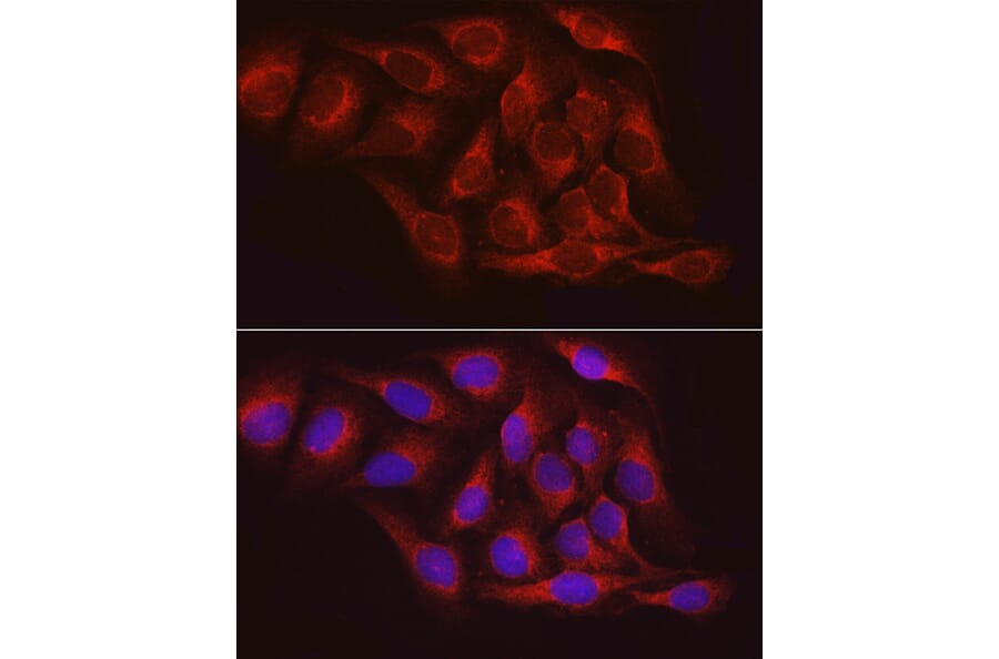 Immunofluorescence - Anti-PTP1B Antibody (A13530) - Antibodies.com
