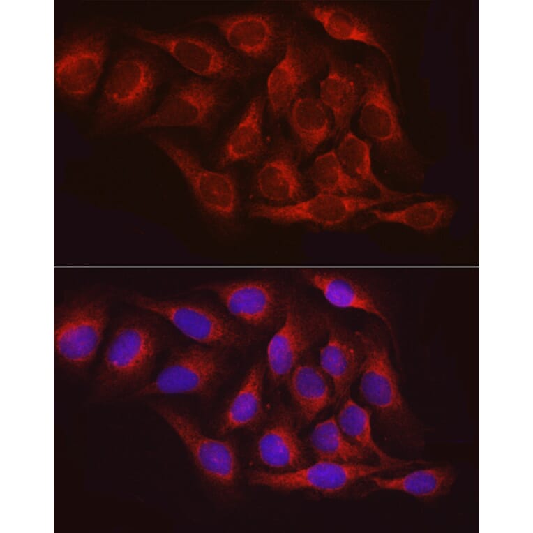 Immunofluorescence - Anti-PTP1B Antibody (A13530) - Antibodies.com