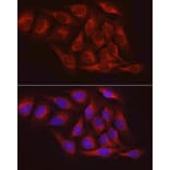 Immunofluorescence - Anti-PTP1B Antibody (A13530) - Antibodies.com