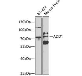 Western Blot - Anti-alpha Adducin Antibody (A13531) - Antibodies.com