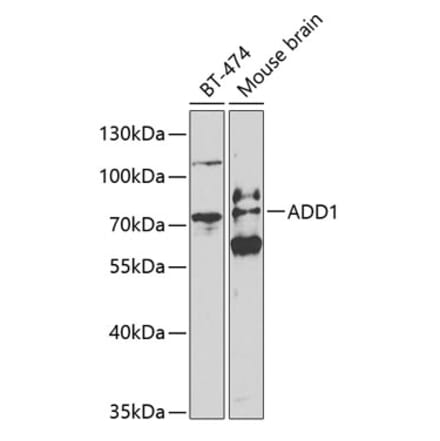 Western Blot - Anti-alpha Adducin Antibody (A13531) - Antibodies.com