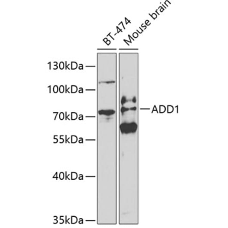 Western Blot - Anti-alpha Adducin Antibody (A13531) - Antibodies.com