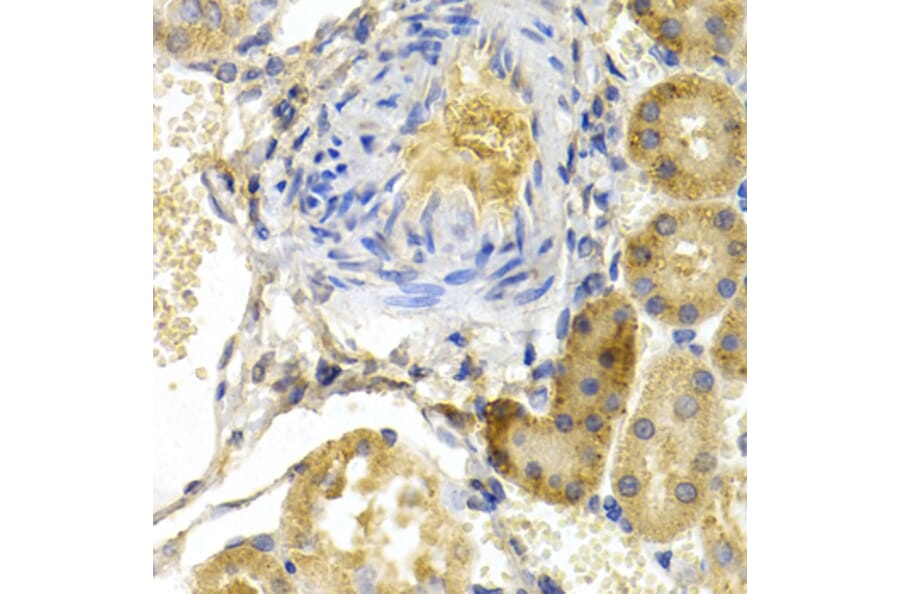Immunohistochemistry - Anti-Bad Antibody (A13532) - Antibodies.com