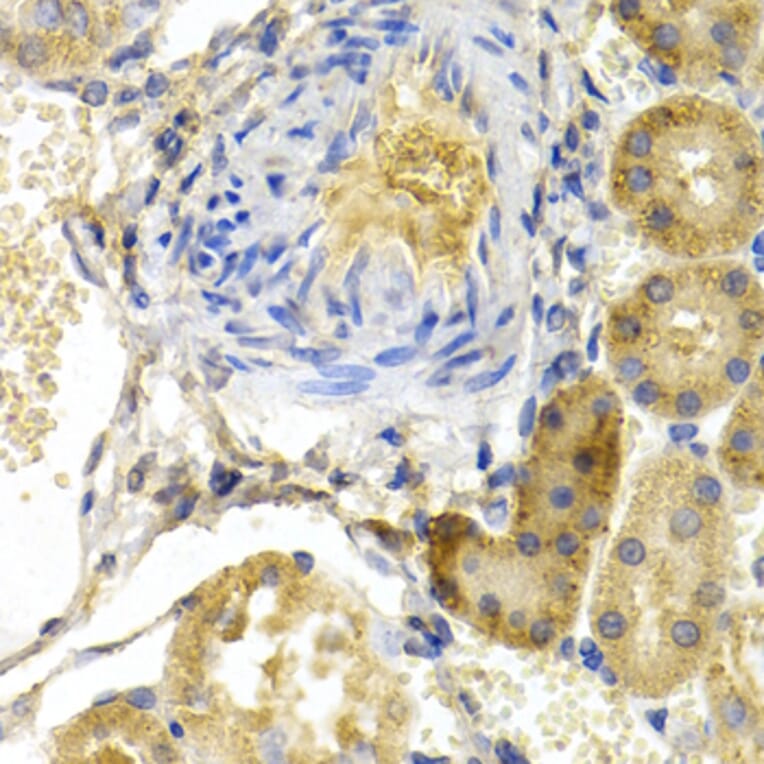 Immunohistochemistry - Anti-Bad Antibody (A13532) - Antibodies.com