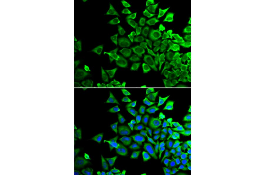 Immunofluorescence - Anti-Bad Antibody (A13532) - Antibodies.com