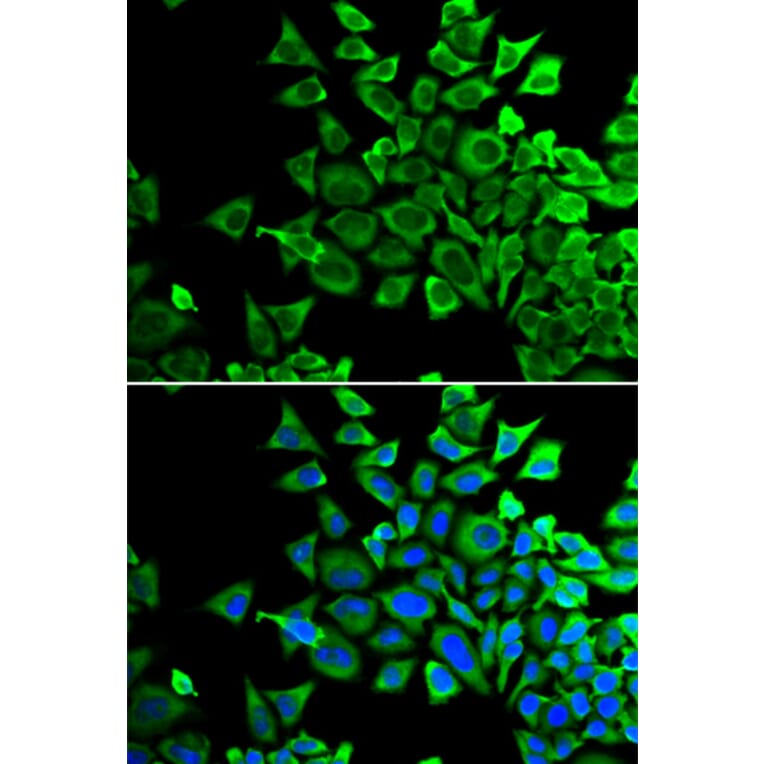 Immunofluorescence - Anti-Bad Antibody (A13532) - Antibodies.com