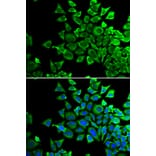 Immunofluorescence - Anti-Bad Antibody (A13532) - Antibodies.com