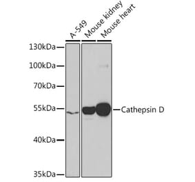 Western Blot - Anti-Cathepsin D Antibody (A13533) - Antibodies.com