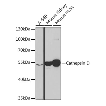 Western Blot - Anti-Cathepsin D Antibody (A13533) - Antibodies.com