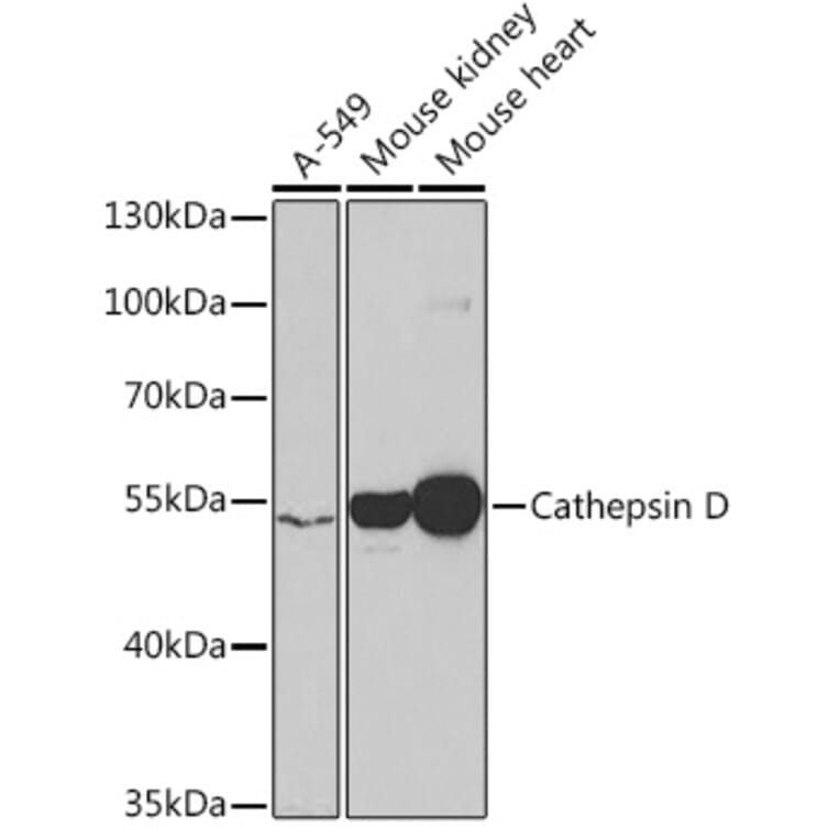 Western Blot - Anti-Cathepsin D Antibody (A13533) - Antibodies.com