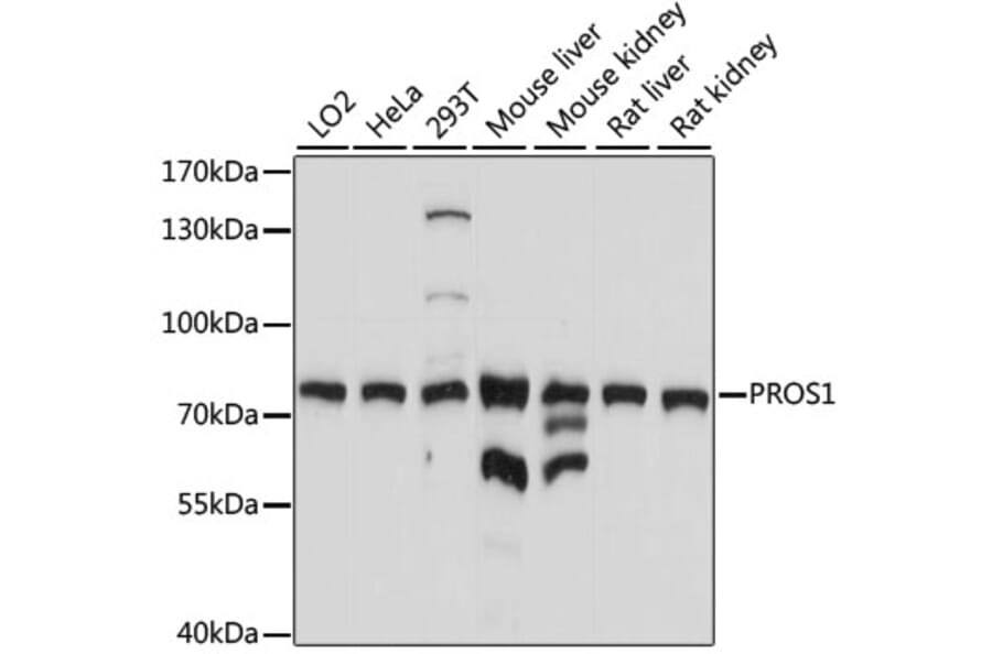 Western Blot - Anti-Protein S Antibody (A13534) - Antibodies.com
