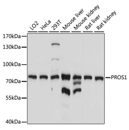 Western Blot - Anti-Protein S Antibody (A13534) - Antibodies.com