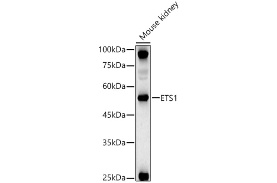 Western Blot - Anti-ETS1 Antibody (A13535) - Antibodies.com