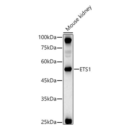 Western Blot - Anti-ETS1 Antibody (A13535) - Antibodies.com