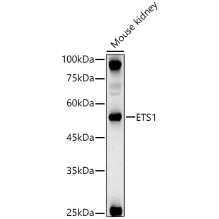 Western Blot - Anti-ETS1 Antibody (A13535) - Antibodies.com