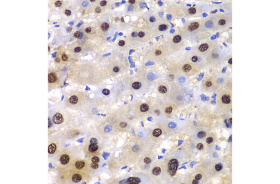 Immunohistochemistry - Anti-ETS1 Antibody (A13535) - Antibodies.com