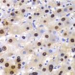 Immunohistochemistry - Anti-ETS1 Antibody (A13535) - Antibodies.com