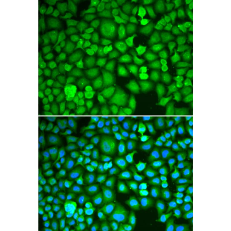 Immunofluorescence - Anti-ETS1 Antibody (A13535) - Antibodies.com