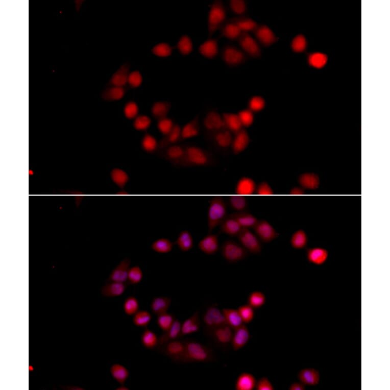 Immunofluorescence - Anti-ETS1 Antibody (A13535) - Antibodies.com