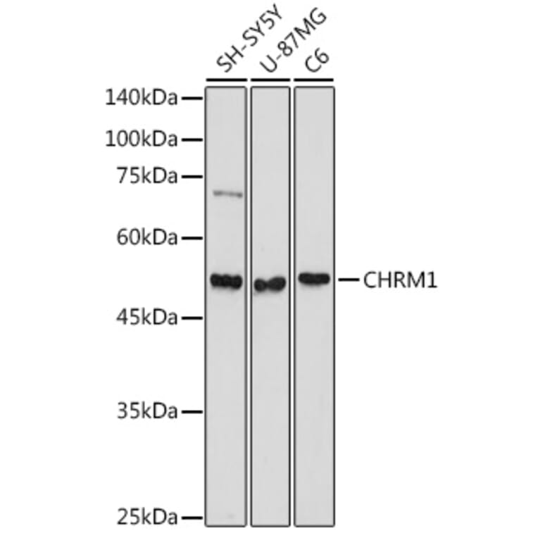 Western Blot - Anti-CHRM1 Antibody (A13536) - Antibodies.com