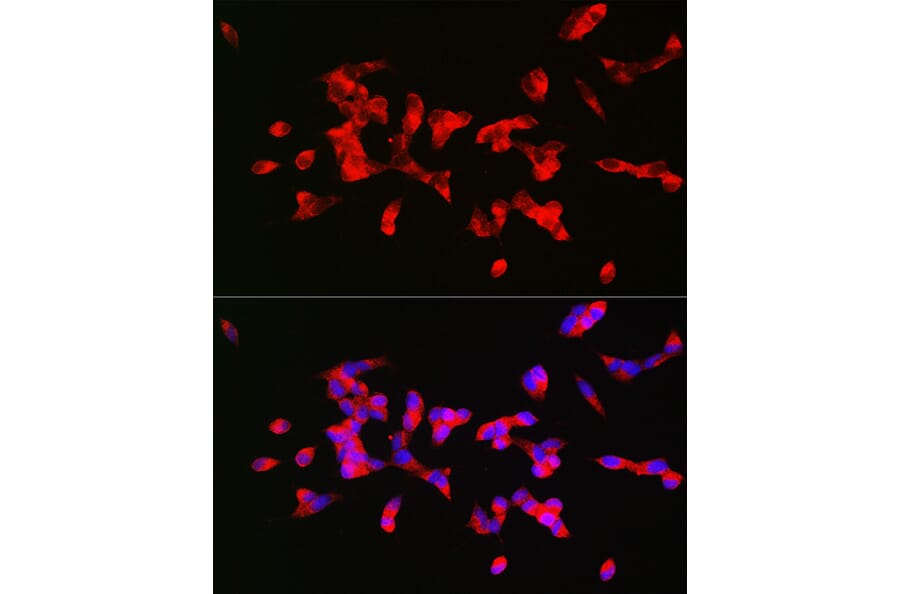 Immunofluorescence - Anti-CHRM1 Antibody (A13536) - Antibodies.com