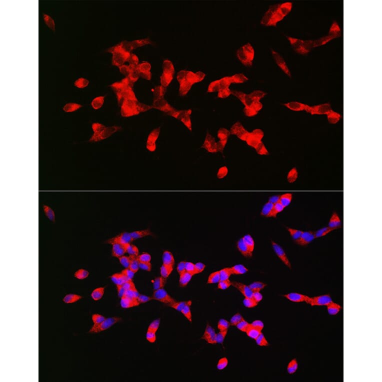 Immunofluorescence - Anti-CHRM1 Antibody (A13536) - Antibodies.com
