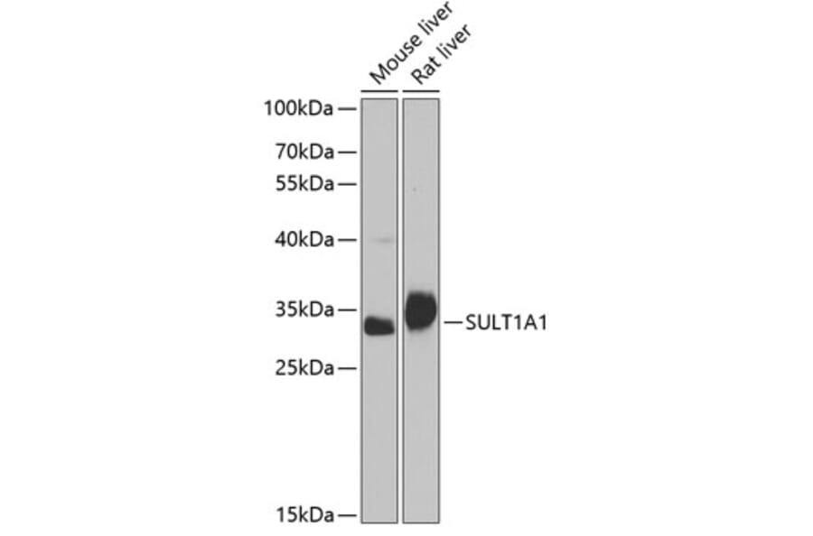 Western Blot - Anti-SULT1A1/STP Antibody (A13537) - Antibodies.com