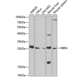 Western Blot - Anti-RBP4 Antibody (A13538) - Antibodies.com