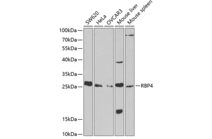 Western Blot - Anti-RBP4 Antibody (A13538) - Antibodies.com