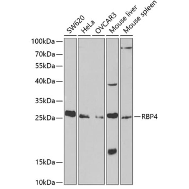 Western Blot - Anti-RBP4 Antibody (A13538) - Antibodies.com