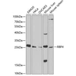 Western Blot - Anti-RBP4 Antibody (A13538) - Antibodies.com