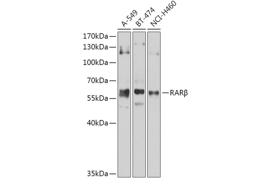 Western Blot - Anti-Retinoic Acid Receptor beta Antibody (A13540) - Antibodies.com